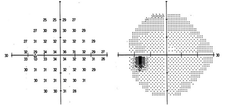(Imagen tomada de base de datos equipo de campo visual Sociedad De Diagnóstico Visual SAS)