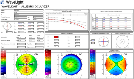 (Imagen tomada de base de datos topógrafo Sociedad De Diagnóstico Visual SAS)